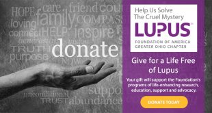 Understanding Lupus and Its Impact