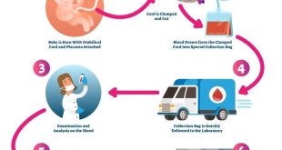 Cord Blood Donation: A Comprehensive Guide